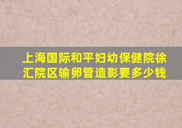 上海国际和平妇幼保健院徐汇院区输卵管造影要多少钱