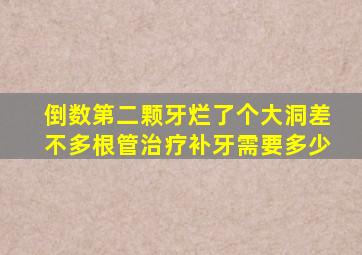 倒数第二颗牙烂了个大洞差不多根管治疗补牙需要多少